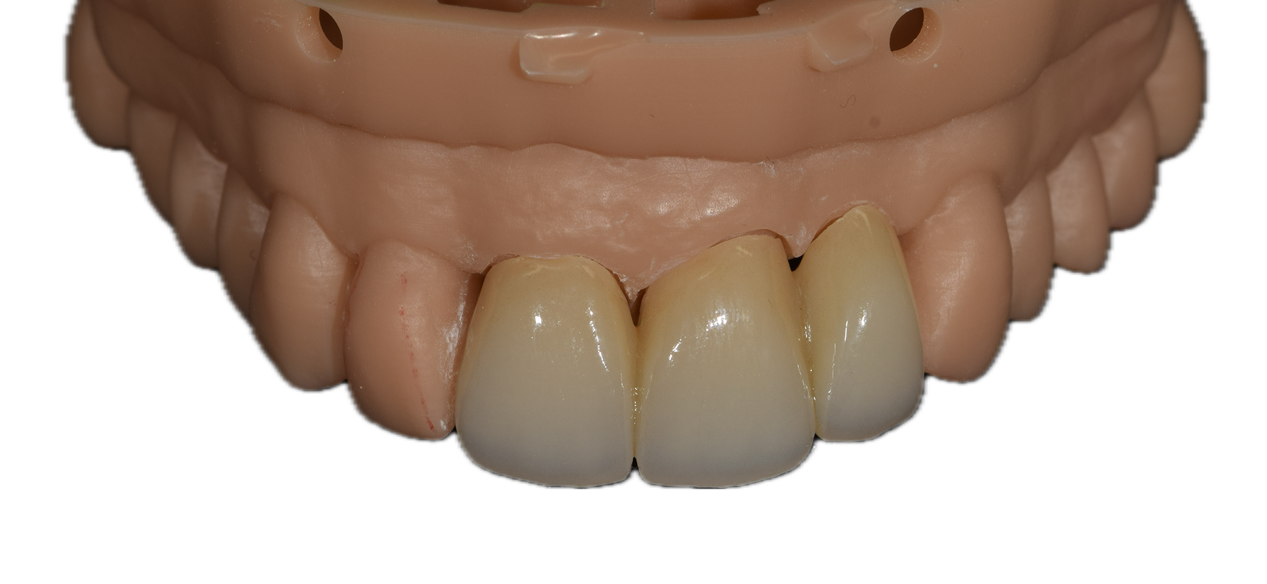 Aesthetic Zirconia 2