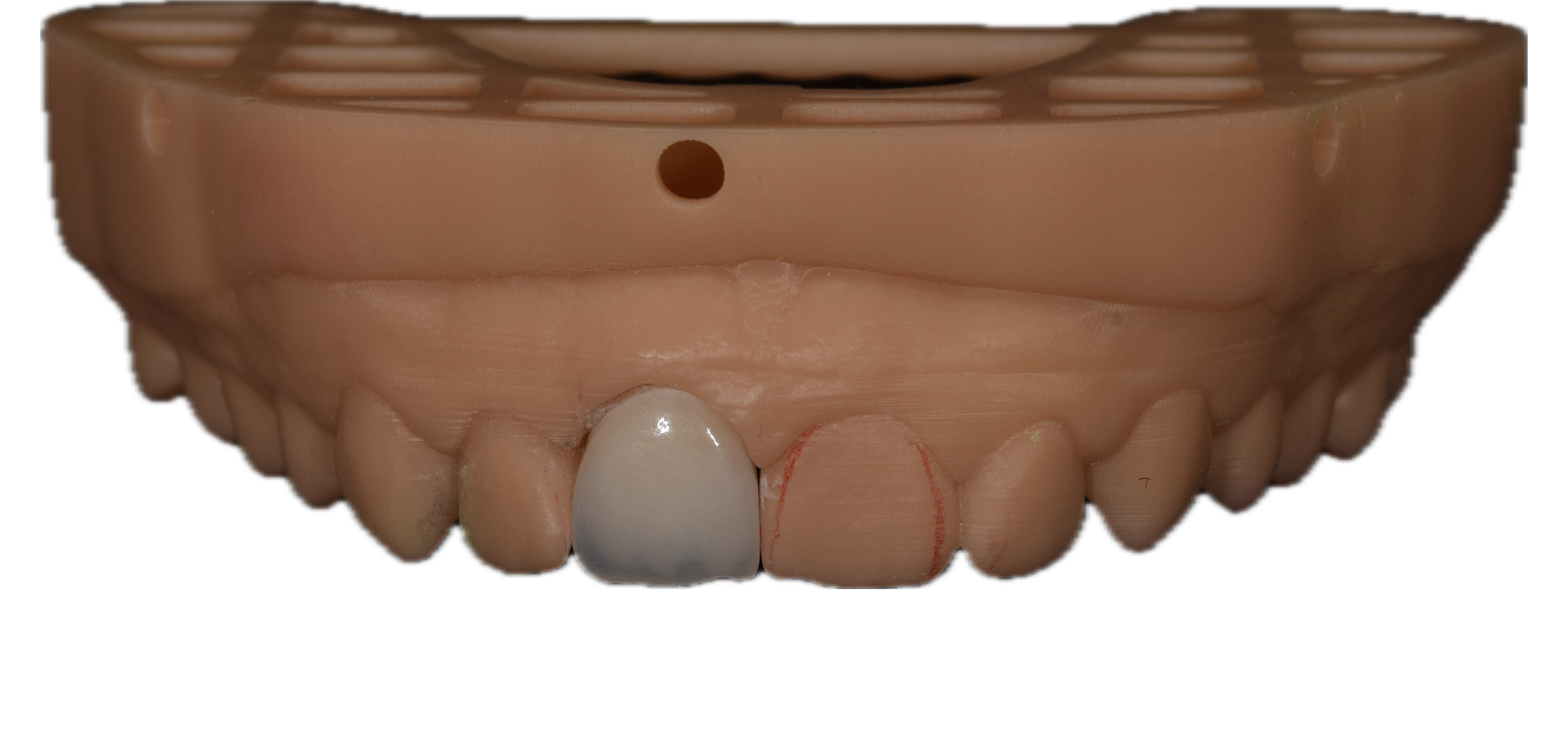 Aesthetic Zirconia 4