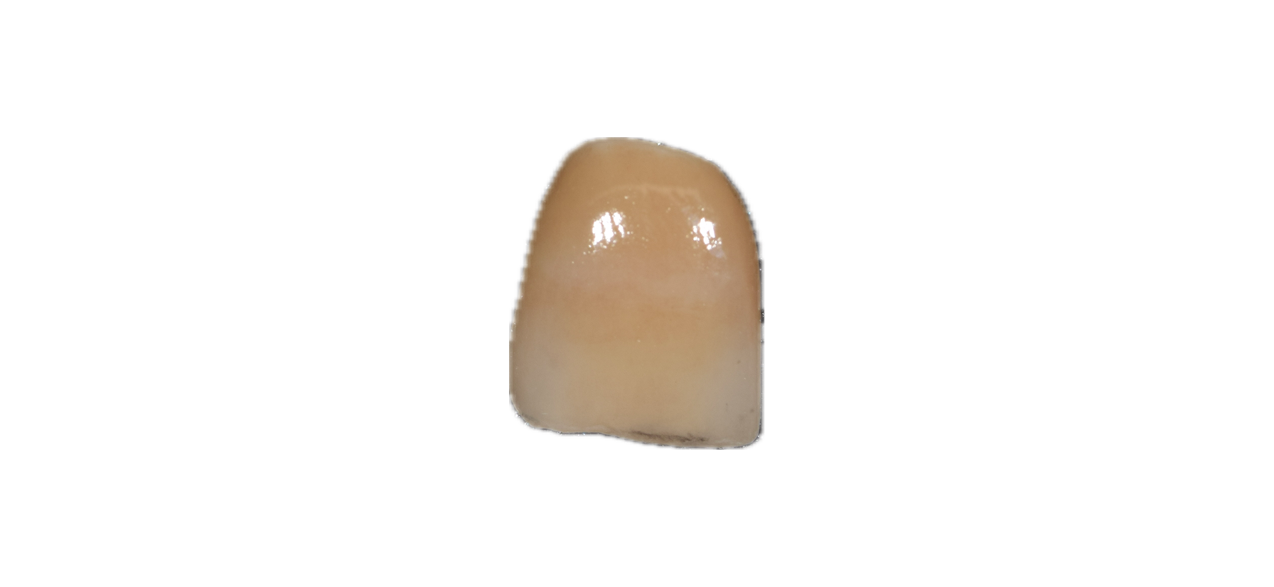 Aesthetic Zirconia 5