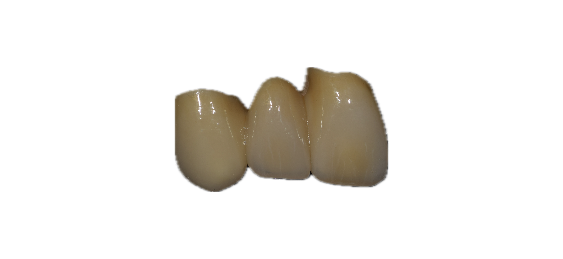 Aesthetic Zirconia 8