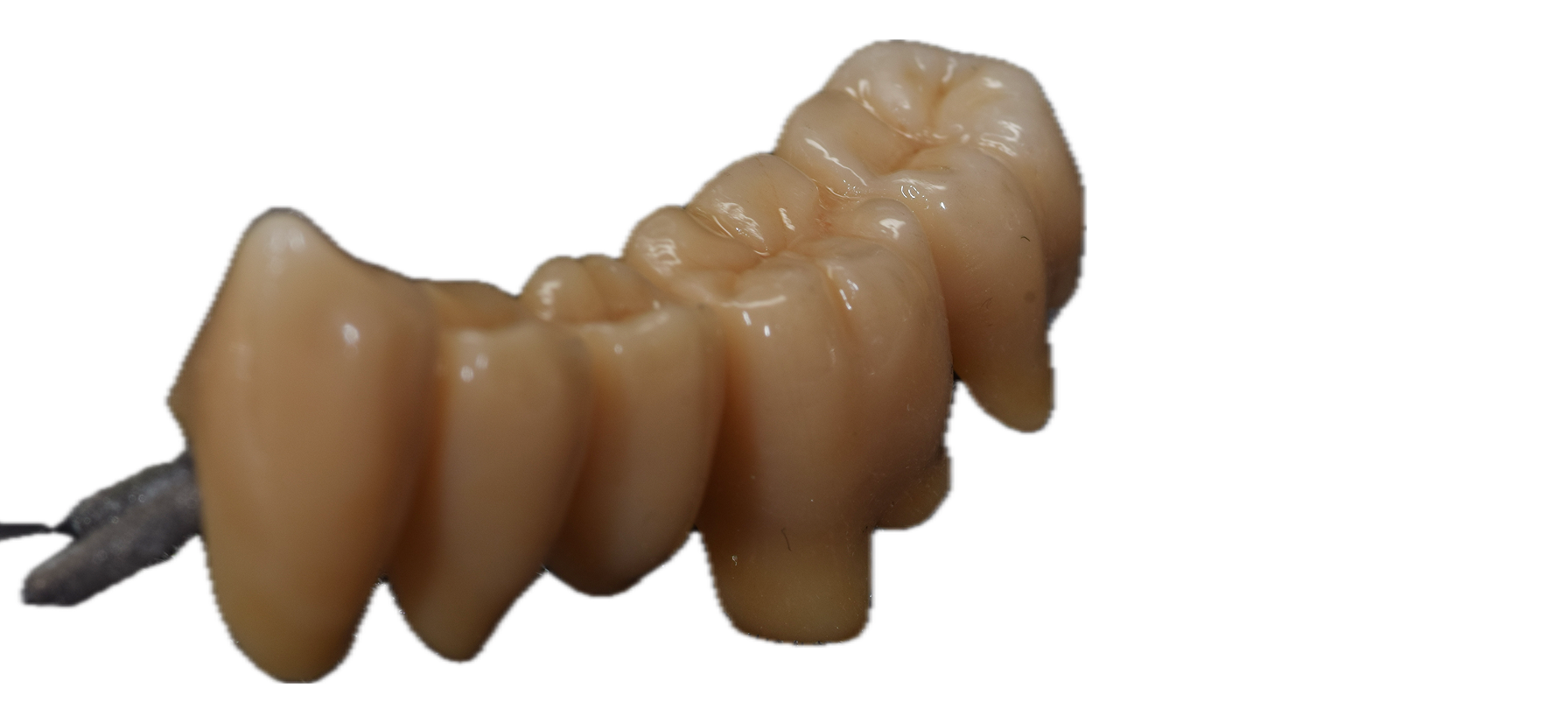 Anatomic Zirconia 9
