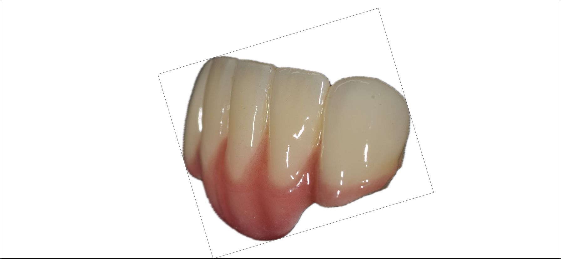 Anatomic Zirconia 4