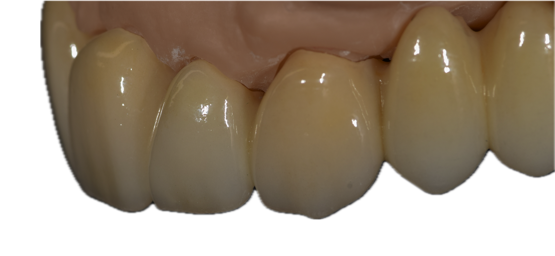 Anatomic Zirconia 5