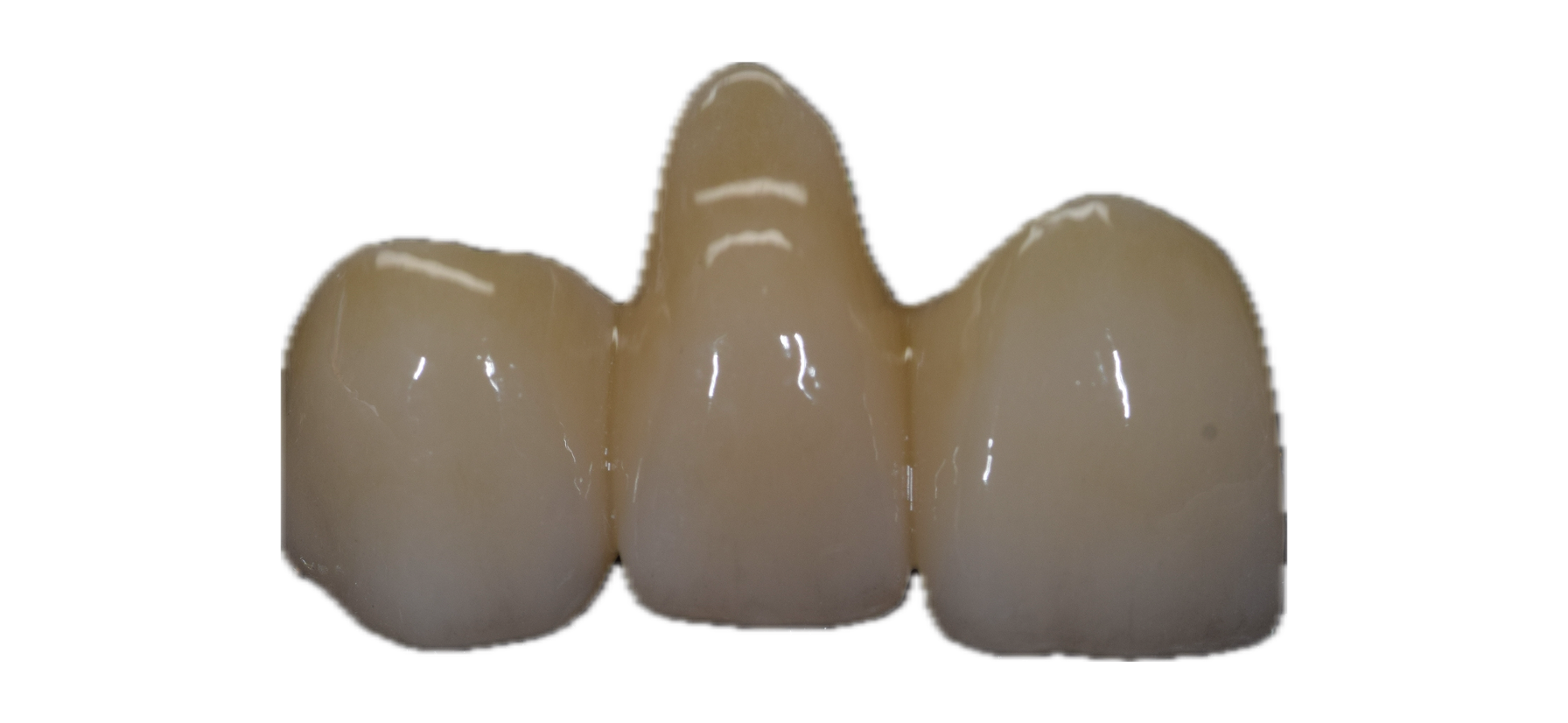 Anatomic Zirconia 7