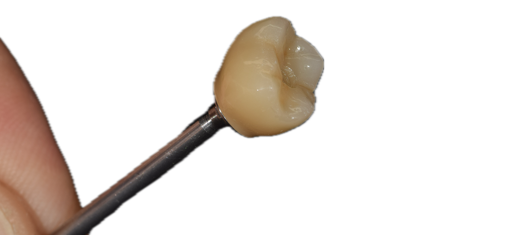Anatomic Zirconia 8